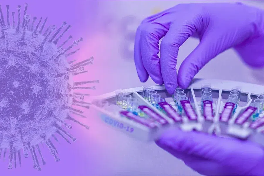 Ученые китайского Уханя заявили о появления нового потенциально опасного коронавируса NeoCoV