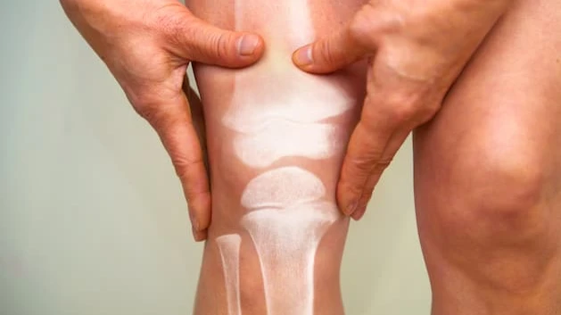 Артроз коленного сустава – распространенное заболевание. Фото: Getty
