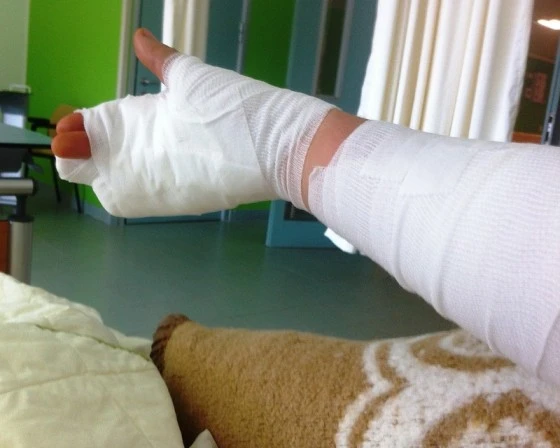 Состояние у мужчины, получившего ожотги, удовлетворительное