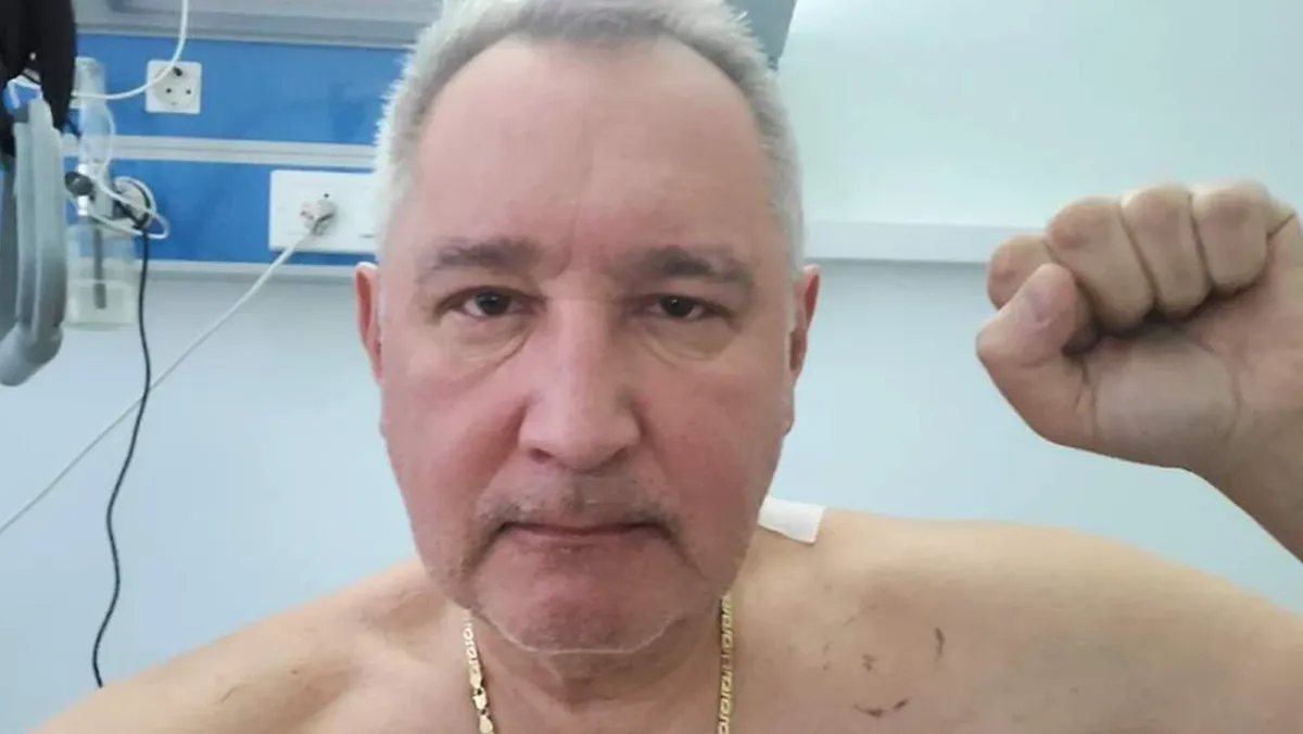Осколок для Макрона и реакция на Галкина*: когда раненный в Донецке Дмитрий Рогозин вернется обратно в зону СВО
