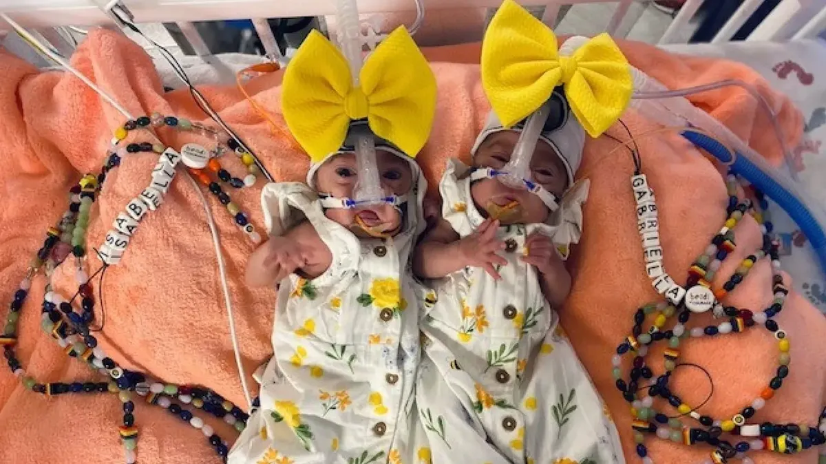 В США женщина родила однояйцевых близнецов Габби и Беллу с разницей в 3 дня: очень редкий случай