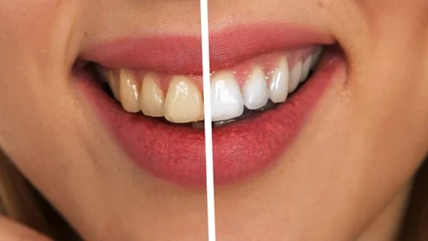 По зубам научились определять, доживете ли человек до 100 лет 
