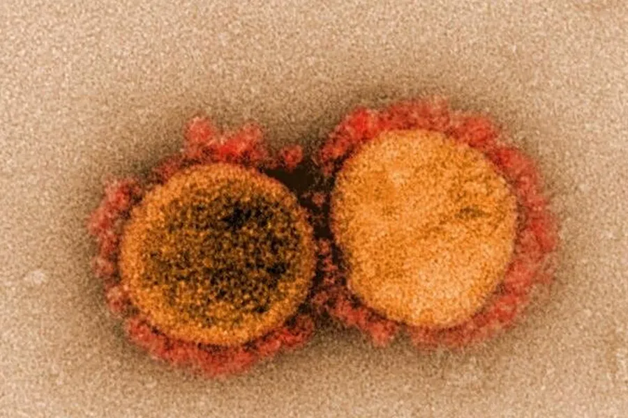 Обнаружение коронавируса: сколько выходов нужно сделать, чтобы распространять вирус