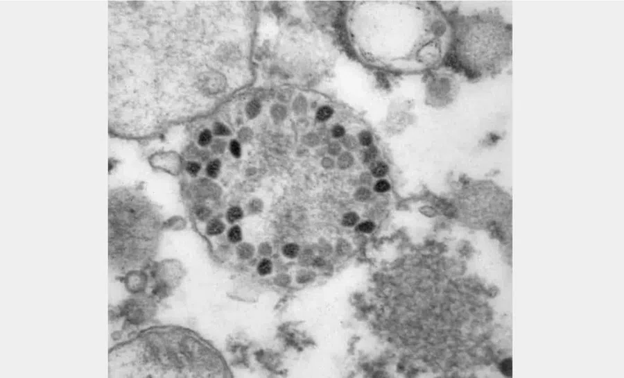 Новый штамм коронавируса «омикрон» на фото показал научный центр вирусологии и биотехнологии «Вектор»