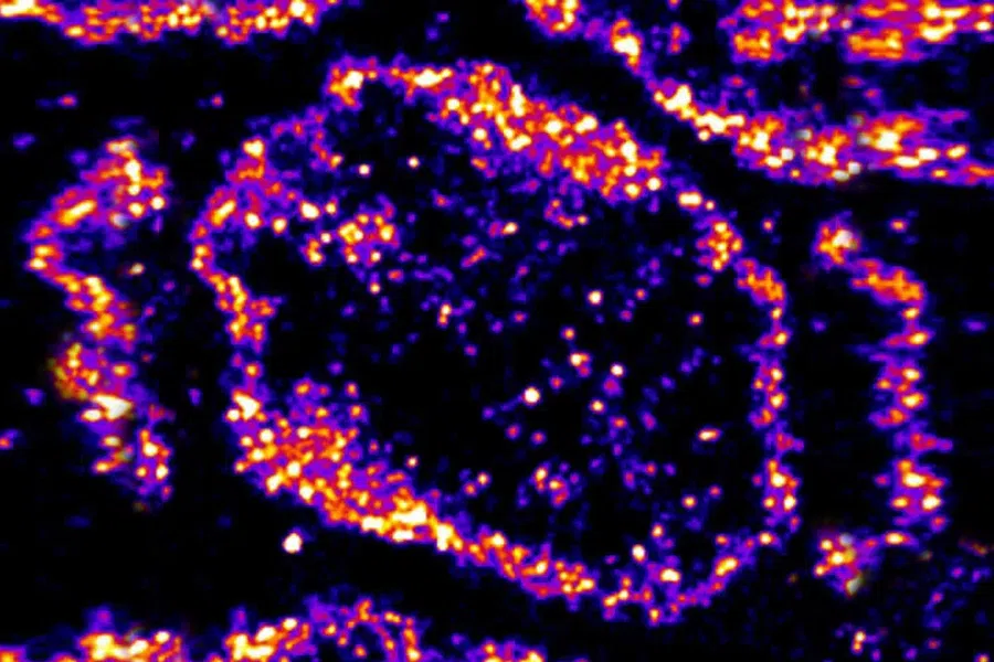 Как увидеть невидимое: новая флуоресцентная метка ДНК выявляет наноскопические признаки рака