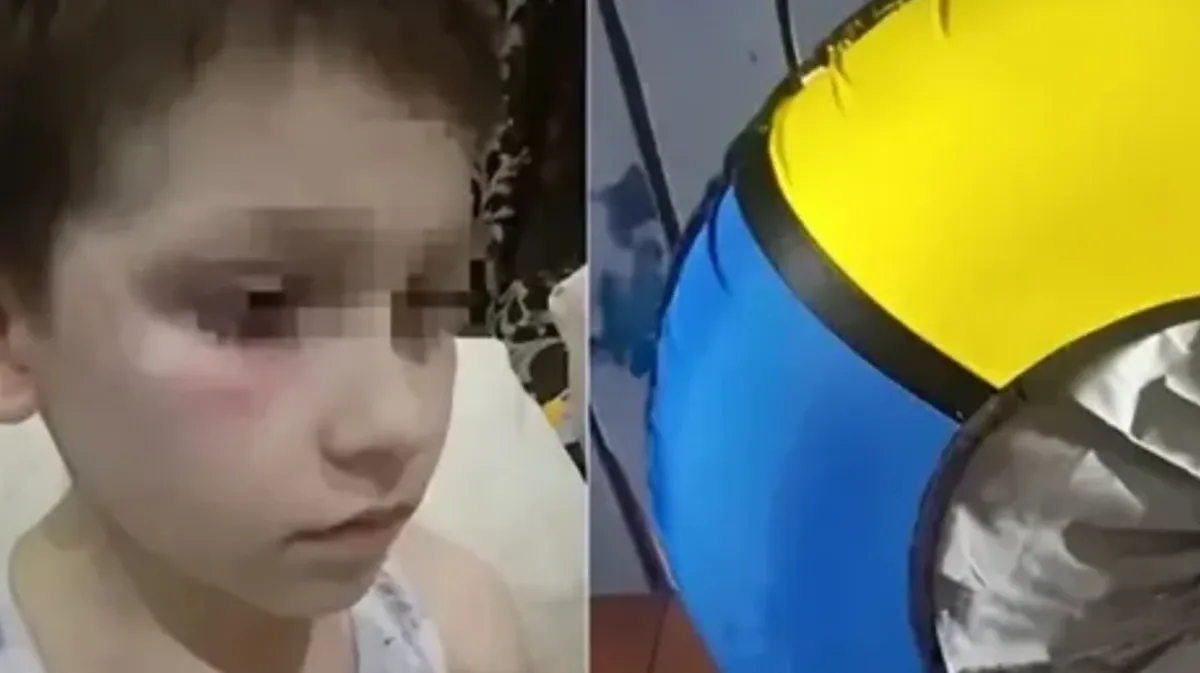 В Кировской области мальчика избили во время катания на горке. В желто-синей «ватрушке» разглядели «флаг Украины»