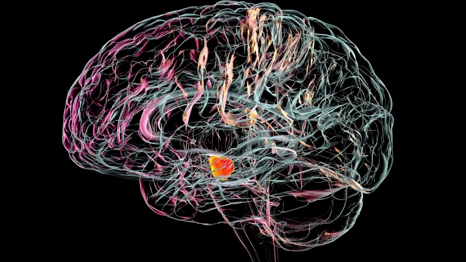 Болезнь Паркинсона вызвана потерей нервных клеток в части мозга, называемой черной субстанцией. Фото: Тhesun.co.uk