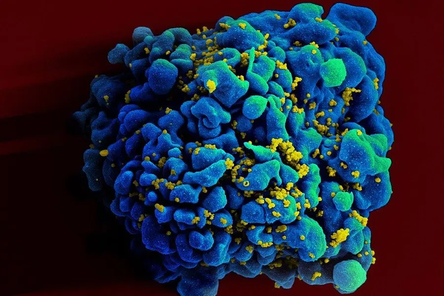 Экспериментальная мРНК вакцина против ВИЧ безопасна и перспективна: проверено на приматах