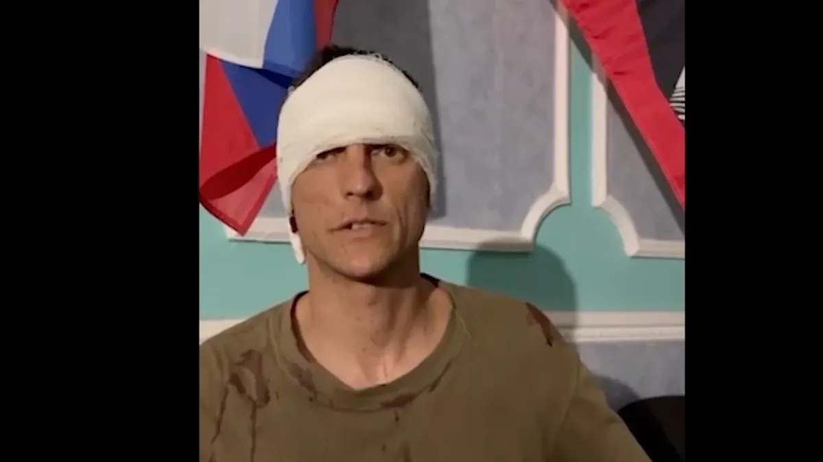 «Мы не бойцы. Завязывайте»: Кадыров показал на видео допрос украинского военнопленного в испачканном от крови свитере