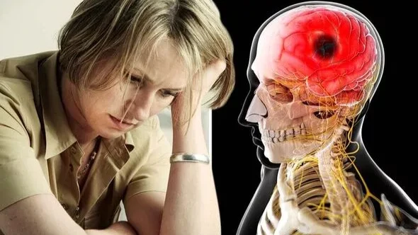 Симптомы инсульта: головная боль может быть признаком. Фото: Getty