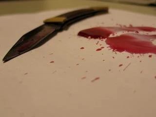 В настоящее время по факту умышленного причинения тяжкого вреда здоровью возбуждено уголовное дело, проводится расследование