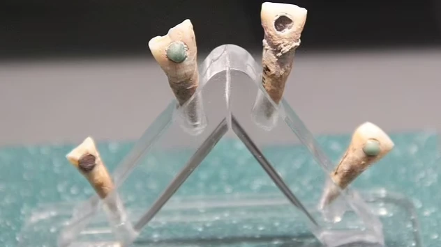 Древние люди Майя прикрепляли нефритовые и бирюзовые украшения к зубам, чтобы предотвратить инфекцию и разрушение, показывают исследования
