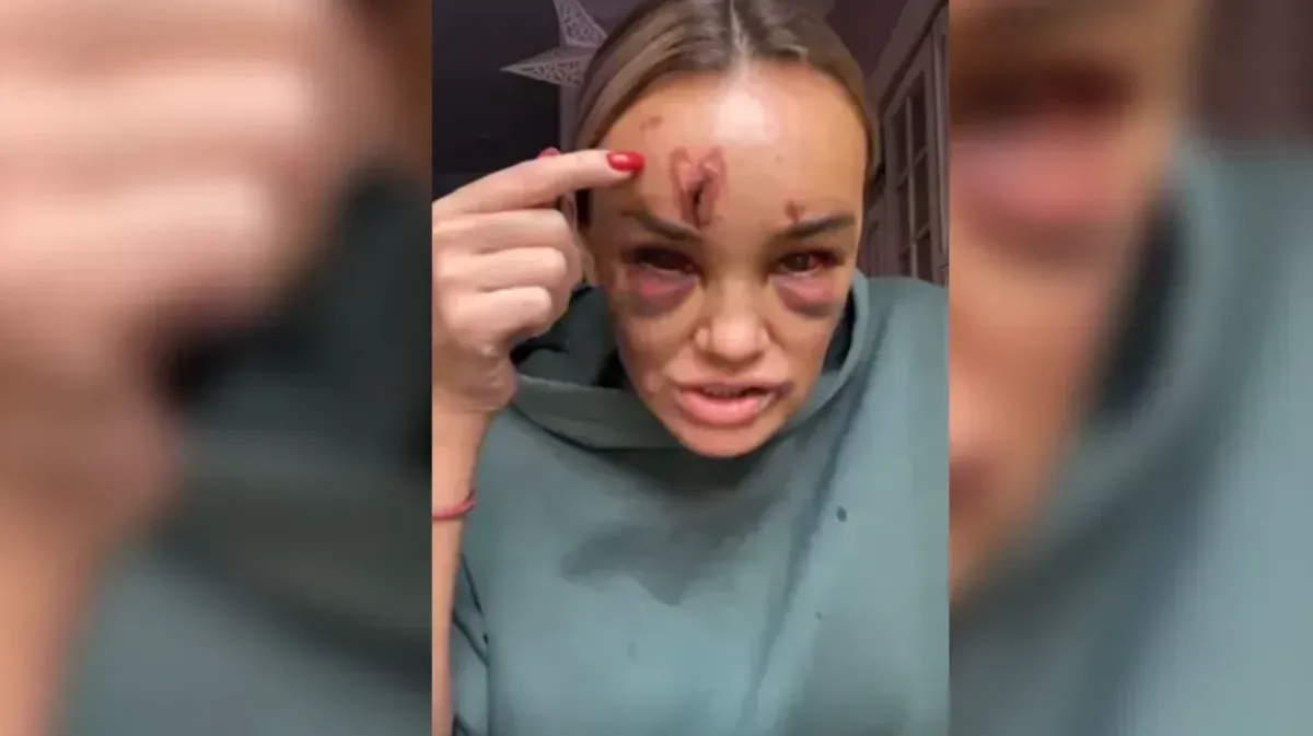В центре Петербурга мужчина из-за замечания жестоко избил журналистку Анну Леонову на глазах у прохожих. Нападавший кричал: «Умри, тварь!» 