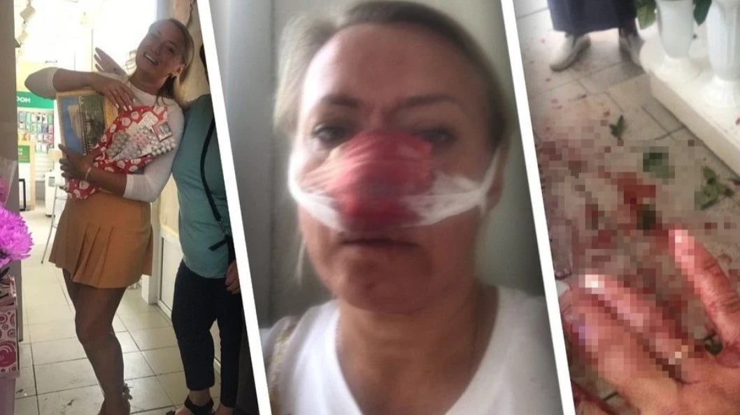 «Хотела помочь, а в результате напоролась»: В Новосибирске прохожий зверски избил флориста и изуродовал ей нос