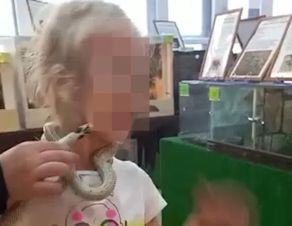 Змея укусила девочку за щеку