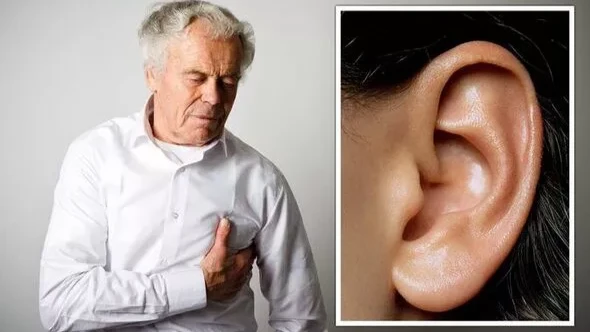  Предупреждение о сердечном приступе: знак на ухе, который может предсказать смертельно опасное состояние — «знак Фрэнка»