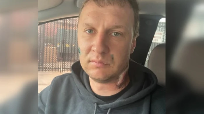 Украинец изрезал своего соотечественника за то, что он «русский» после устроенного ему экзамена в баре Нью-Йорка