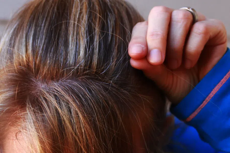Седина у молодых: почему волосы седеют до 35 лет и о чем сигналит организм