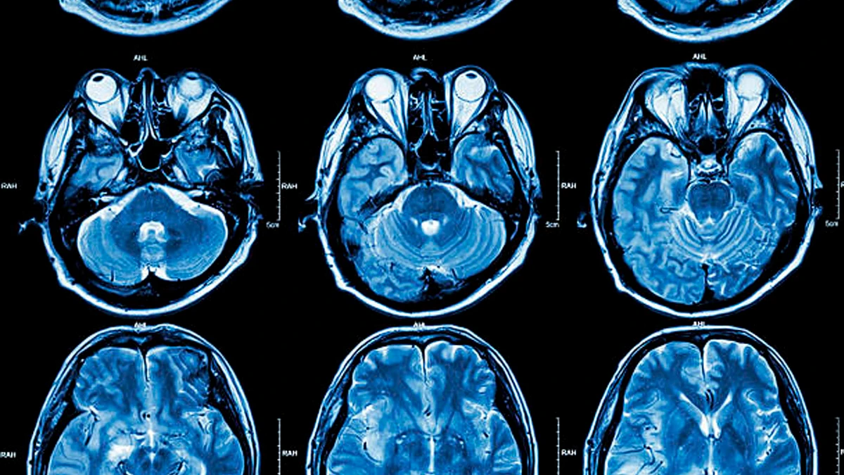 Смерть клеток головного мозга может привести к множеству проблем с познанием, таких как повышенная путаница и дезориентация, общение, мышление и рассуждения. Фото: Pexels.com