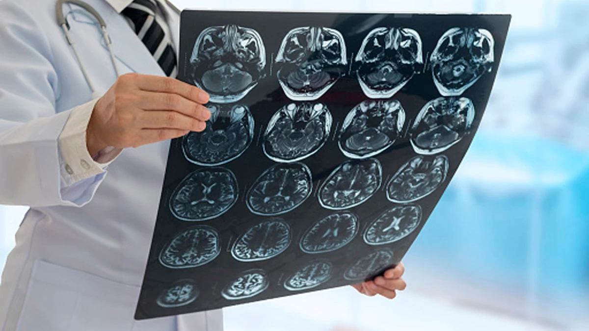 Ученые говорят, что они определили тип клеток мозга, связанных с болезнью Паркинсона. Фото: Pixabay.com